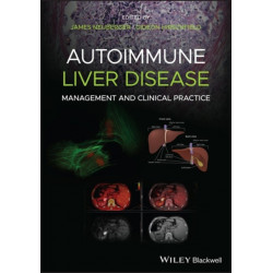 Autoimmune Liver Disease: Management and Clinical Practice