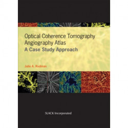 Optical Coherence Tomography Angiography Atlas: A Case Study Approach
