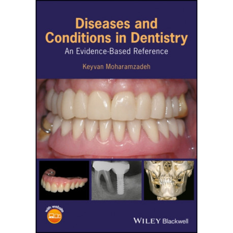 Diseases and Conditions in Dentistry: An Evidence-Based Reference