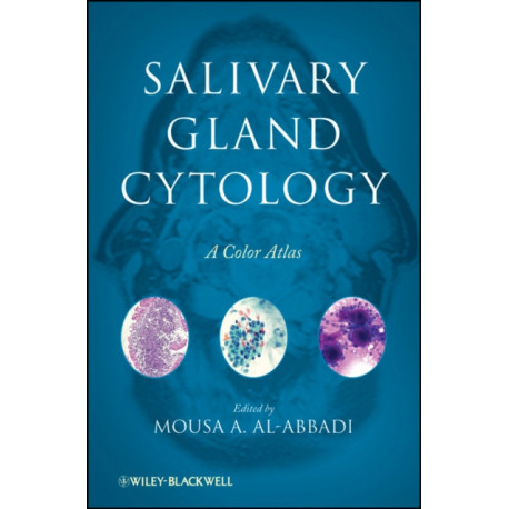 Salivary Gland Cytology: A Color Atlas