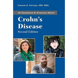 Questions and Answers About Crohn's Disease