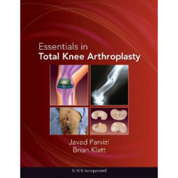 Essentials in Total Knee Arthroplasty