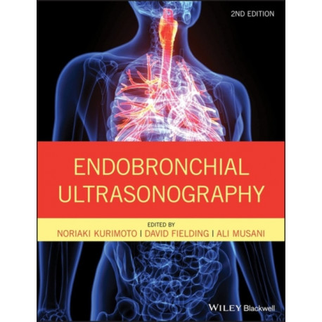 Endobronchial Ultrasonography