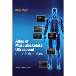 Atlas of Musculoskeletal Ultrasound of the Extremities