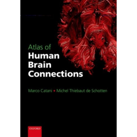 Atlas of Human Brain Connections