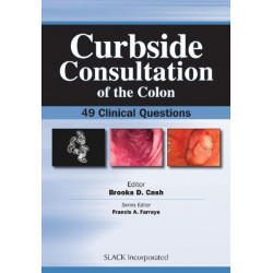 Curbside Consultation of the Colon: 49 Clinical Questions