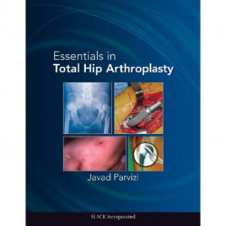 Essentials in Total Hip Arthroplasty