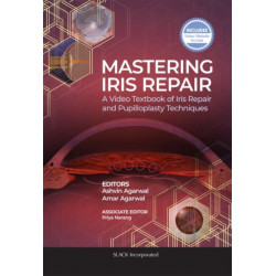 Mastering Iris Repair: A Video Textbook of Iris Repair and Pupilloplasty Techniques