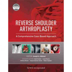 Reverse Shoulder Arthroplasty: A Comprehensive Case-Based Approach