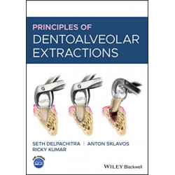 Principles of Dentoalveolar Extractions