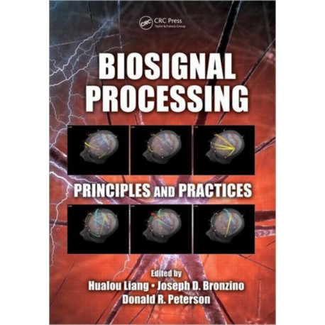 Biosignal Processing: Principles and Practices