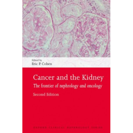 Cancer and the Kidney: The frontier of nephrology and oncology