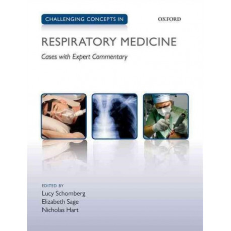 Challenging Concepts in Respiratory Medicine: Cases with Expert Commentary