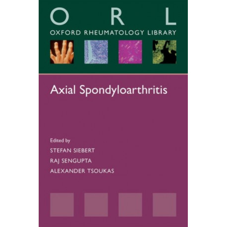 Axial Spondyloarthritis