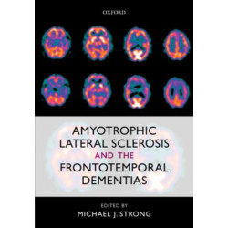 Amyotrophic Lateral Sclerosis and the Frontotemporal Dementias