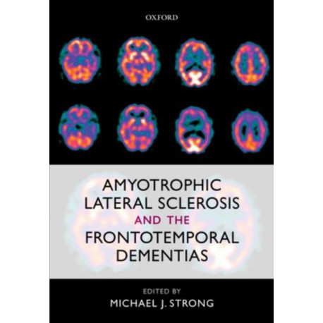 Amyotrophic Lateral Sclerosis and the Frontotemporal Dementias
