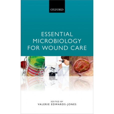 Essential Microbiology for Wound Care