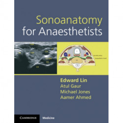 Sonoanatomy for Anaesthetists