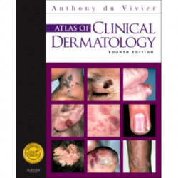 Atlas of Clinical Dermatology