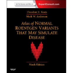 Atlas of Normal Roentgen Variants That May Simulate Disease: Expert Consult - Enhanced Online Features and Print