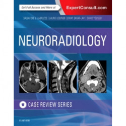 Neuroradiology Imaging Case Review