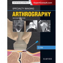 Specialty Imaging: Arthrography