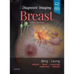 Diagnostic Imaging: Breast