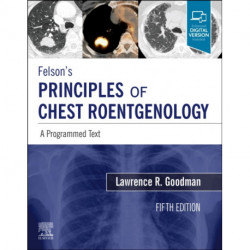 Felson's Principles of Chest Roentgenology, A Programmed Text: A Programmed Text