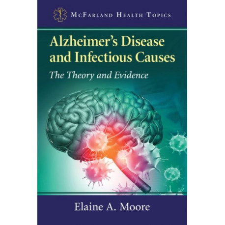 Alzheimer's Disease and Infectious Causes: The Theory and Evidence