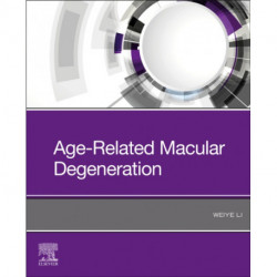 Age-Related Macular Degeneration