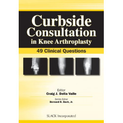 Curbside Consultation in Knee Arthroplasty: 49 Clinical Questions