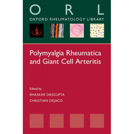 Polymyalgia Rheumatica and Giant Cell Arteritis
