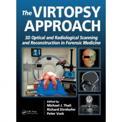 The Virtopsy Approach: 3D Optical and Radiological Scanning and Reconstruction in Forensic Medicine