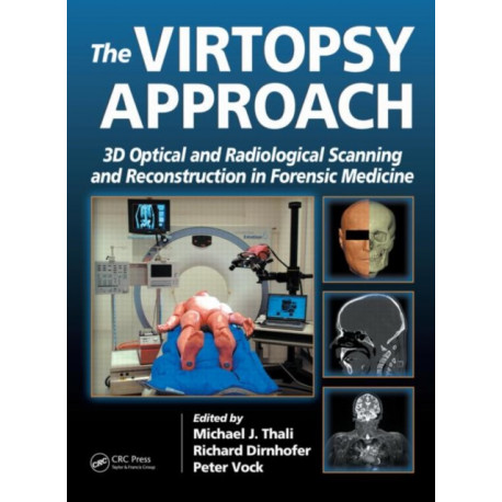 The Virtopsy Approach: 3D Optical and Radiological Scanning and Reconstruction in Forensic Medicine