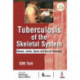 Tuberculosis of the Skeletal System
