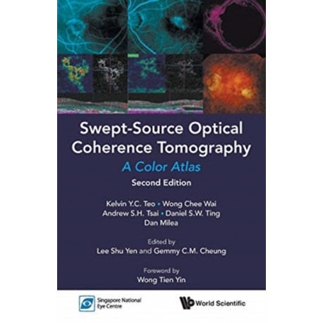 Swept-source Optical Coherence Tomography: A Color Atlas