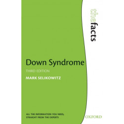 Down Syndrome