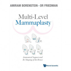 Multi-level Mammaplasty: Anatomical Support And Re-shaping Of The Breast