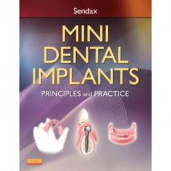 Mini Dental Implants: Principles and Practice