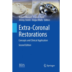 Extra-Coronal Restorations: Concepts and Clinical Application