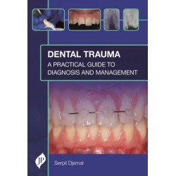 Dental Trauma: A Practical Guide to Diagnosis and Management
