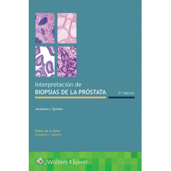 Interpretacion de biopsias de la prostata