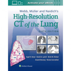 Webb, Muller and Naidich's High-Resolution CT of the Lung