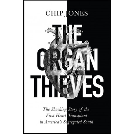 The Organ Thieves