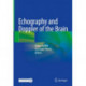 Echography and Doppler of the Brain