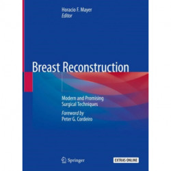 Breast Reconstruction: Modern and Promising Surgical Techniques