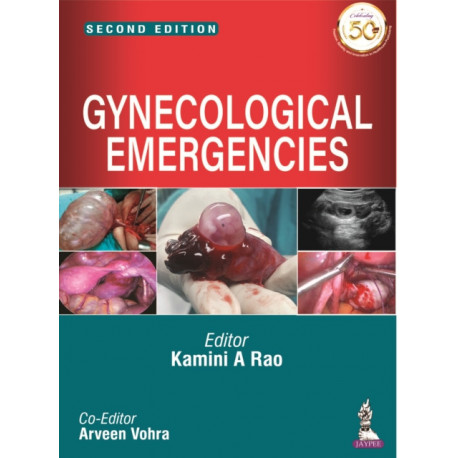 Gynecological Emergencies