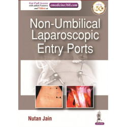 Non-Umbilical Laparoscopic Entry Ports