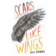 Scars Like Wings