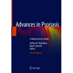 Advances in Psoriasis: A Multisystemic Guide
